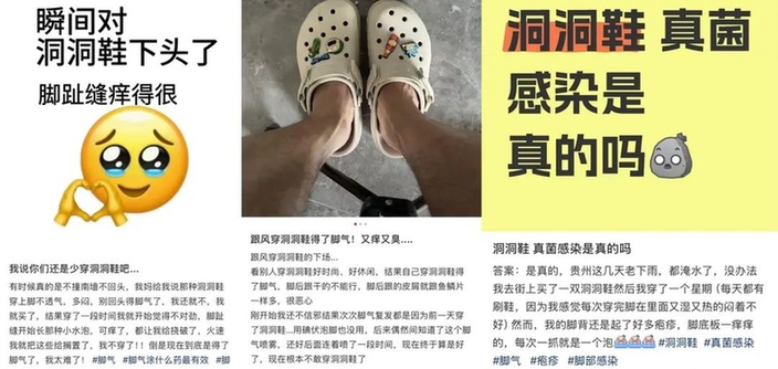 可能增加真菌感染风险！这种鞋不要长期穿